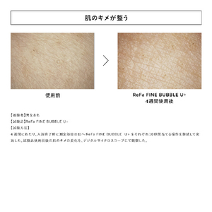 MTG ReFa FINE BUBBLE U+ RS-DE-54A-イメージ4